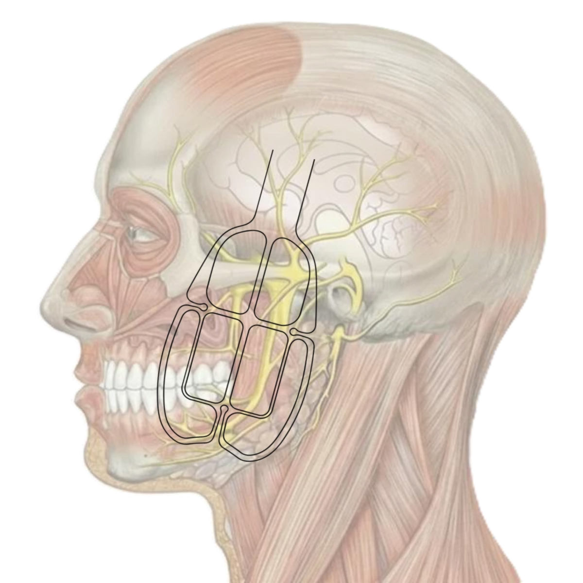 EMFACE® TMJ & Jaw Pain Treatment