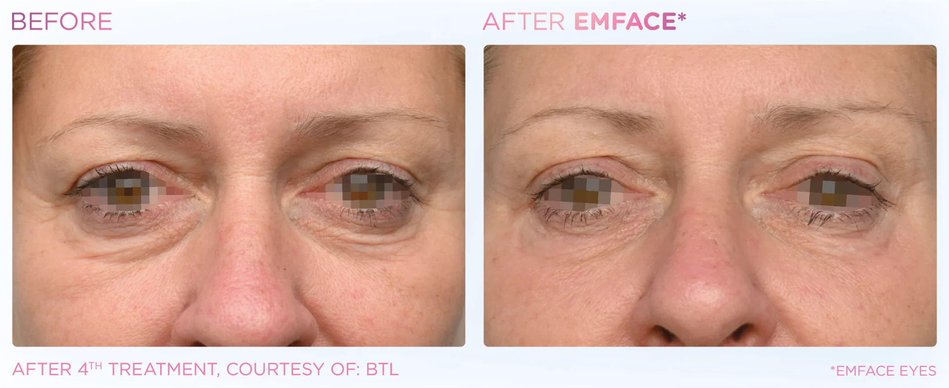 After Treatment